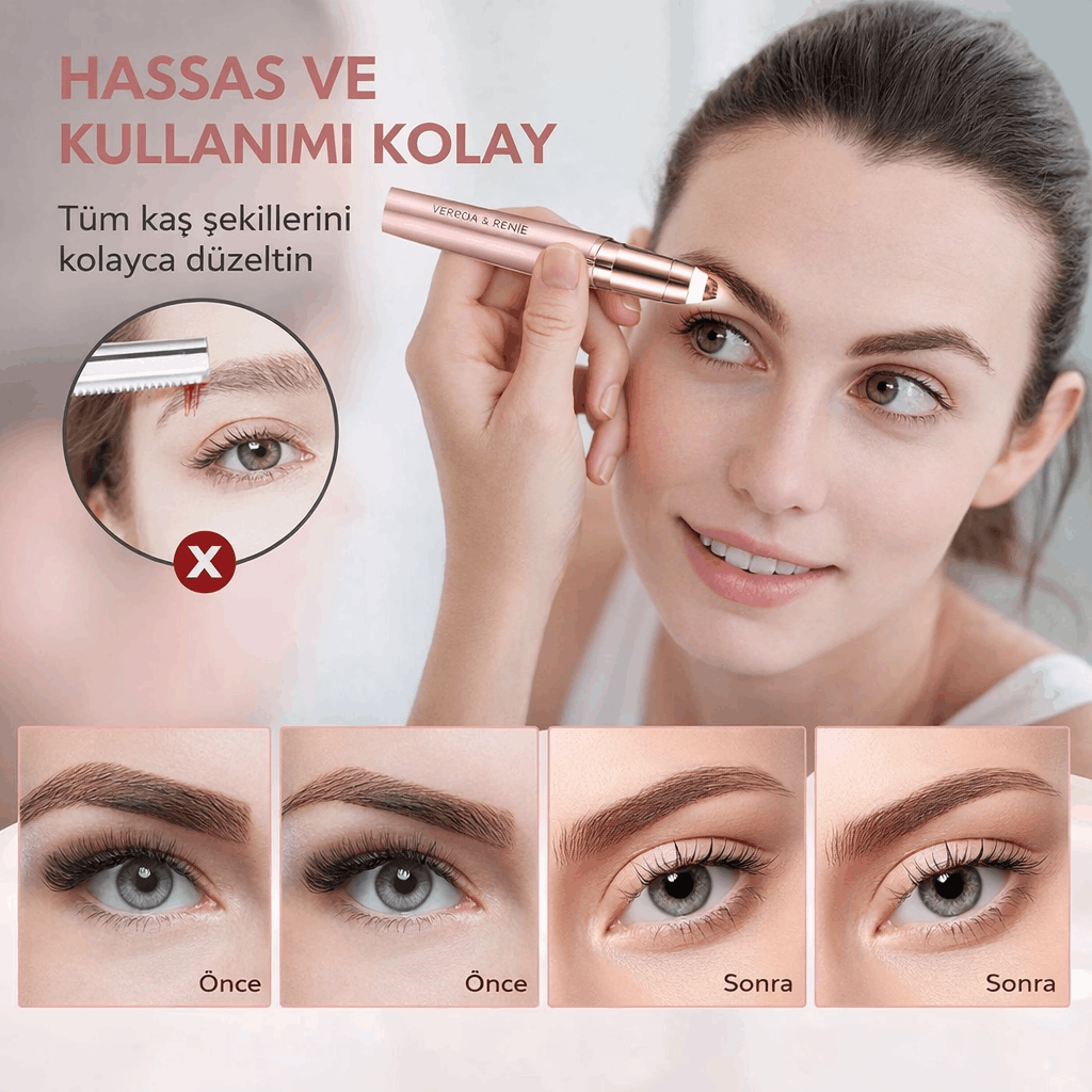 Verona Renée™ Pürüz